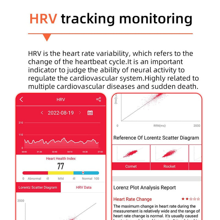 Bloeddruk-smartwatch met hartslagmeter, ronde wijzerplaat, gezondheidsregistratie, verstelbaar, ECG