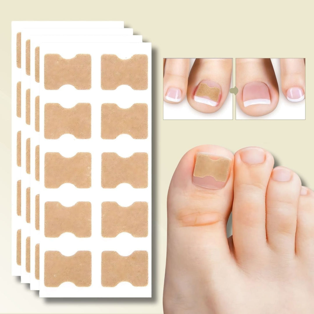 Pleisters voor ingegroeide teennagels met zelfklevende achterkant voor het rechtzetten van nagels, 20 stuks
